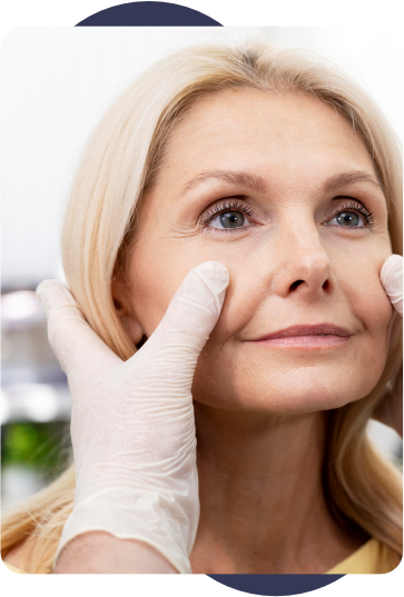 Blefaroplastia