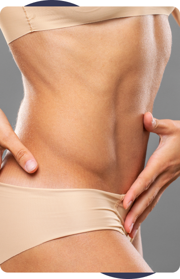 Consulta para abdominoplastia