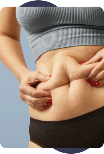 Gordura na Barriga
